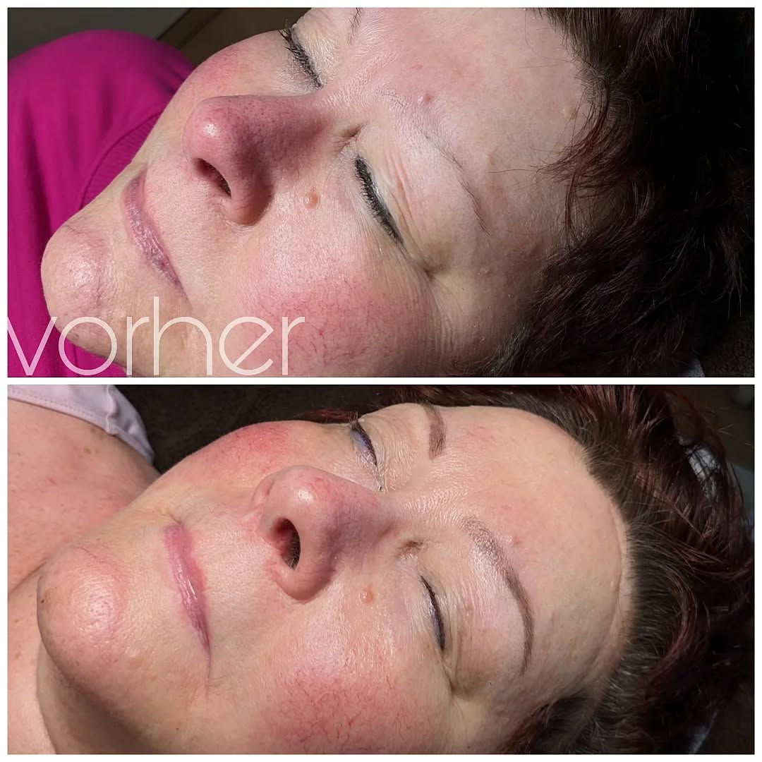 Permanent Make-up Ergebnis, Behandlung 3